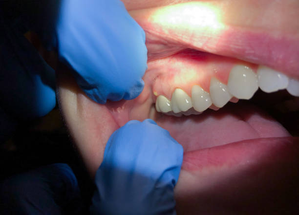 Best Pediatric Emergency Dentist in South Dennis, NJ